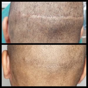 SMP Scar camouflage Atlanta GA