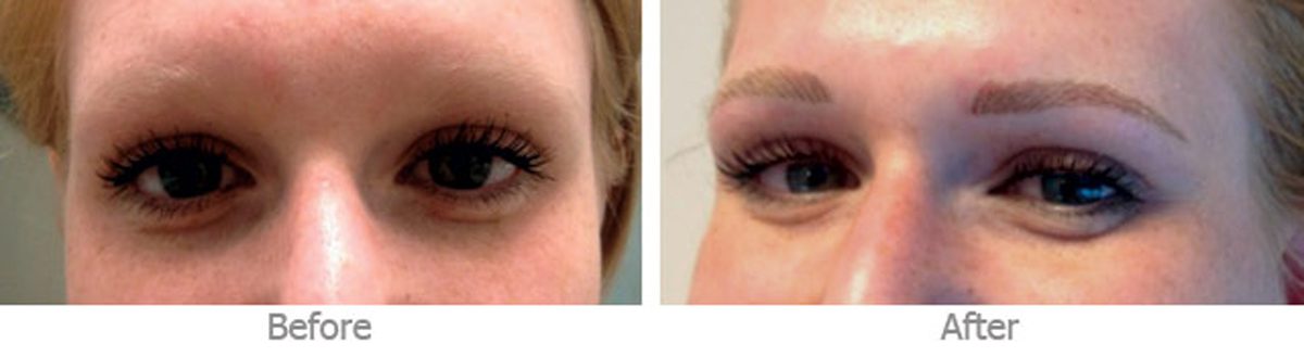 eyebrow tattoo results