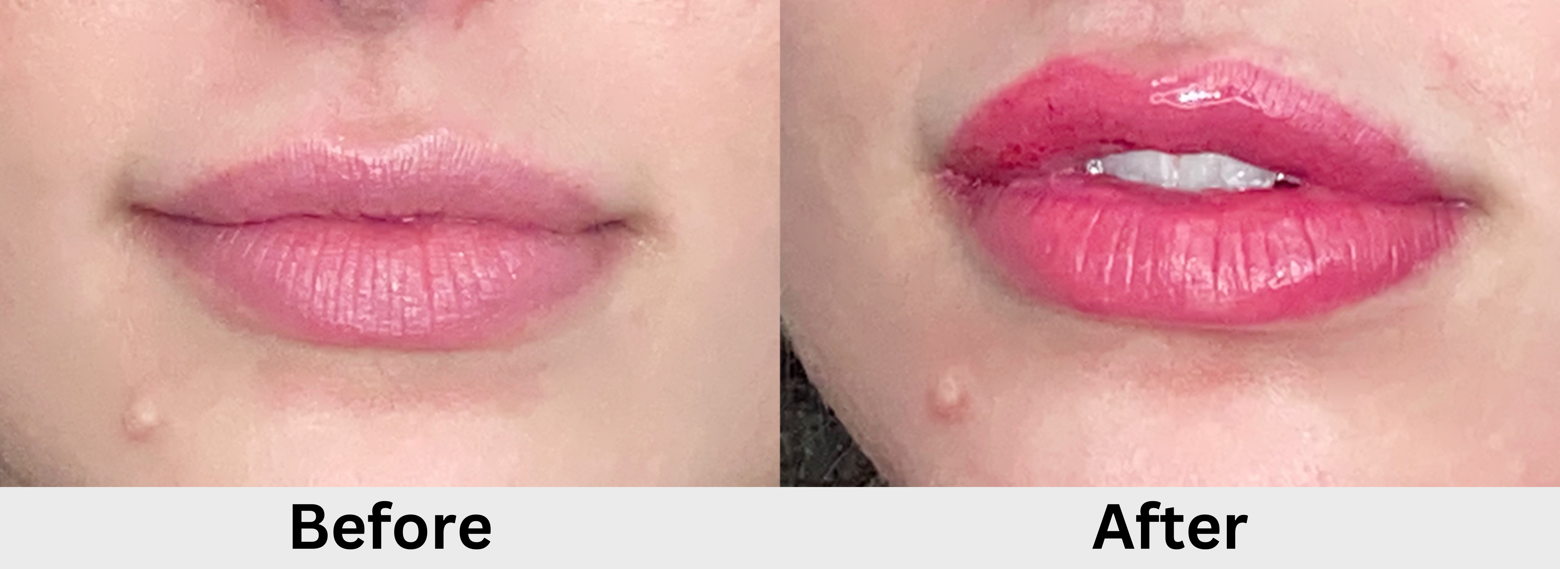 Semi-Permanent Lip Color before and after pictures