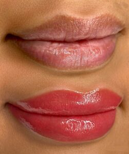 Lip,Blush,Tattoo,Treatment,Before,And,After,,Plump,Lips,, | Look Natural Micropigmentation Clinic Close-up of lips before and after lip neutralization showing a natural pink, even-toned finish.
