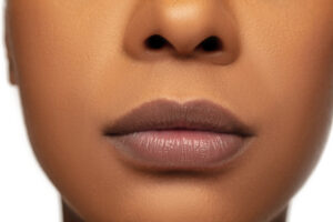 Close-up of female lips with dark pigmentation before lip neutralization.