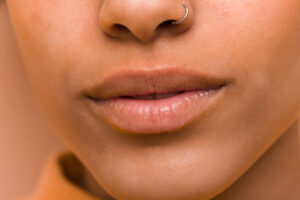Close-up of a woman’s natural lips with slight pigmentation before lip neutralization treatment.