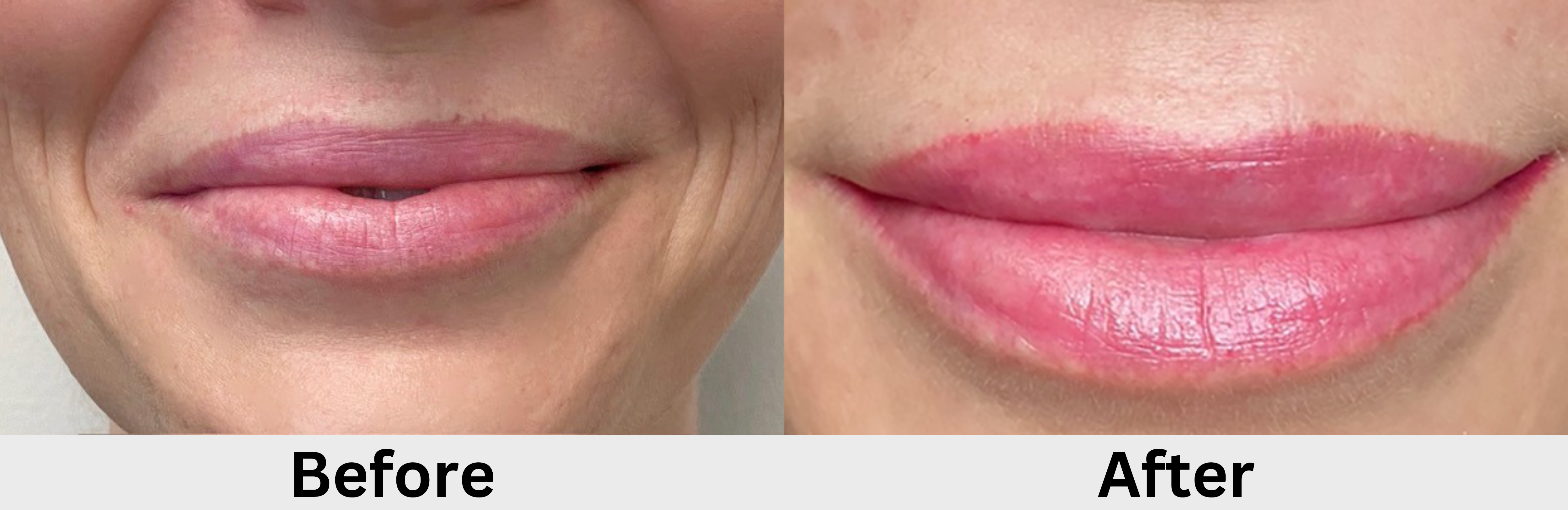 Semi-Permanent Lip Color before and after