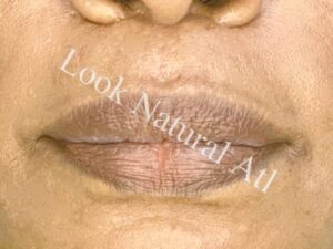 Best Lip Neutralization artist Sandy Springs
