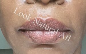 Lip Neutralization artist Sandy Springs