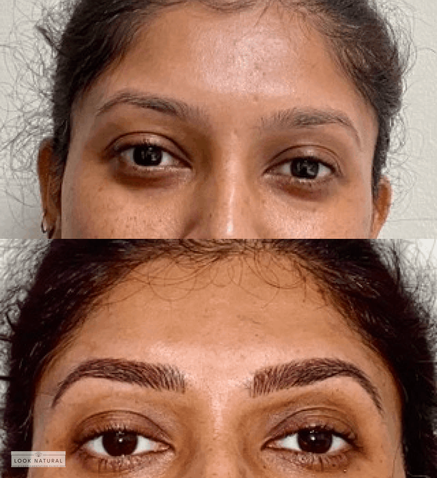 Before and after women’s eyebrow restoration treatment with naturally enhanced brows.