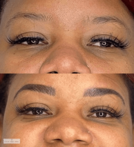 Before and after women’s eyebrow restoration showing defined, natural-looking brows.