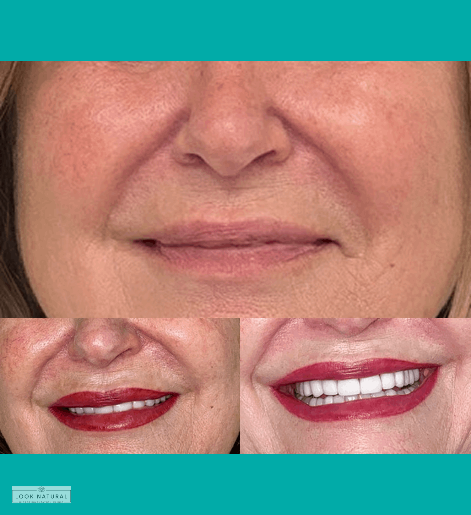 Semi-permanent lip color enhancement for fuller, well-defined lips with natural red tone.
