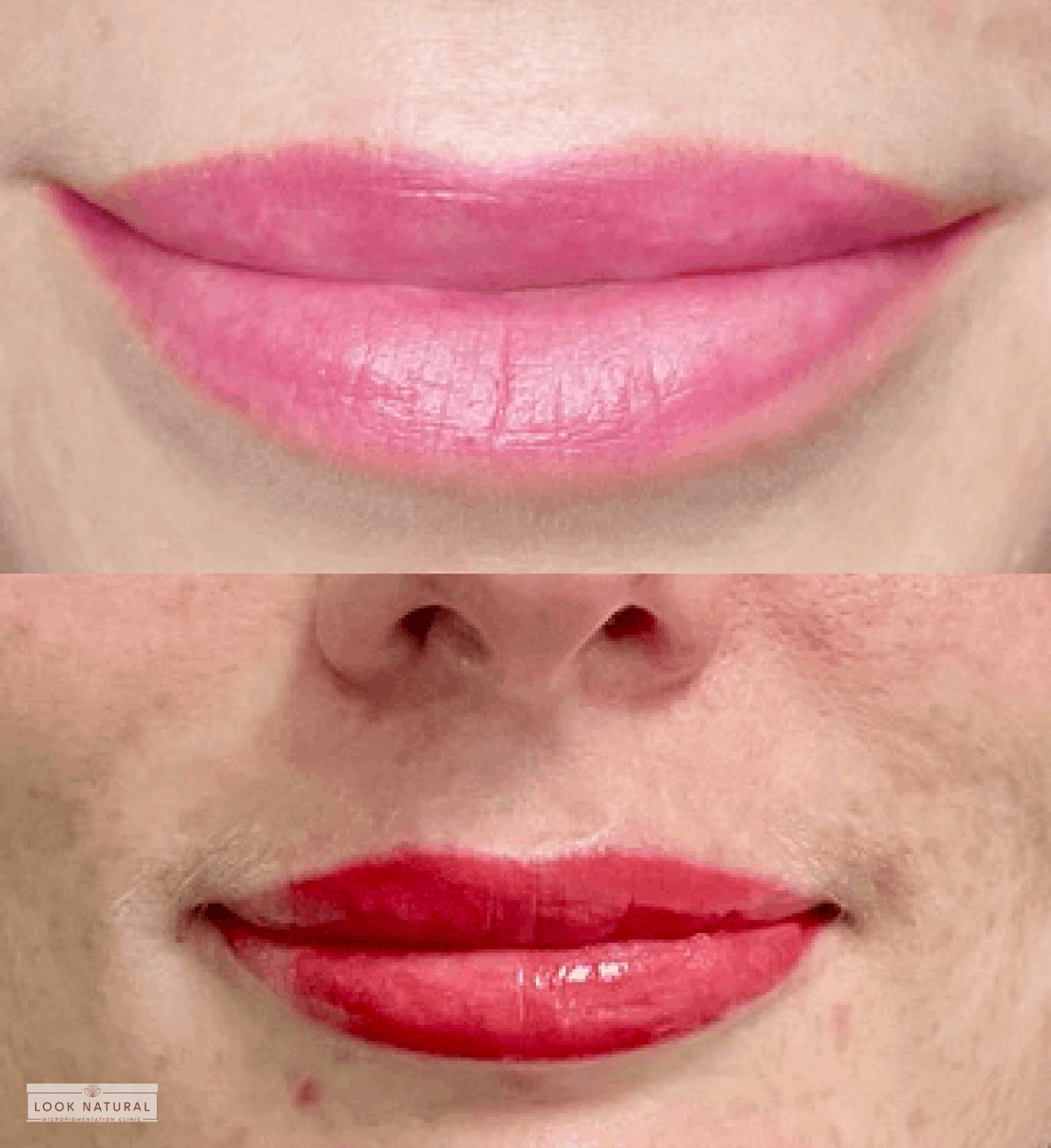 Semi-permanent lip coloring treatment showing natural enhancement with a soft red shade.