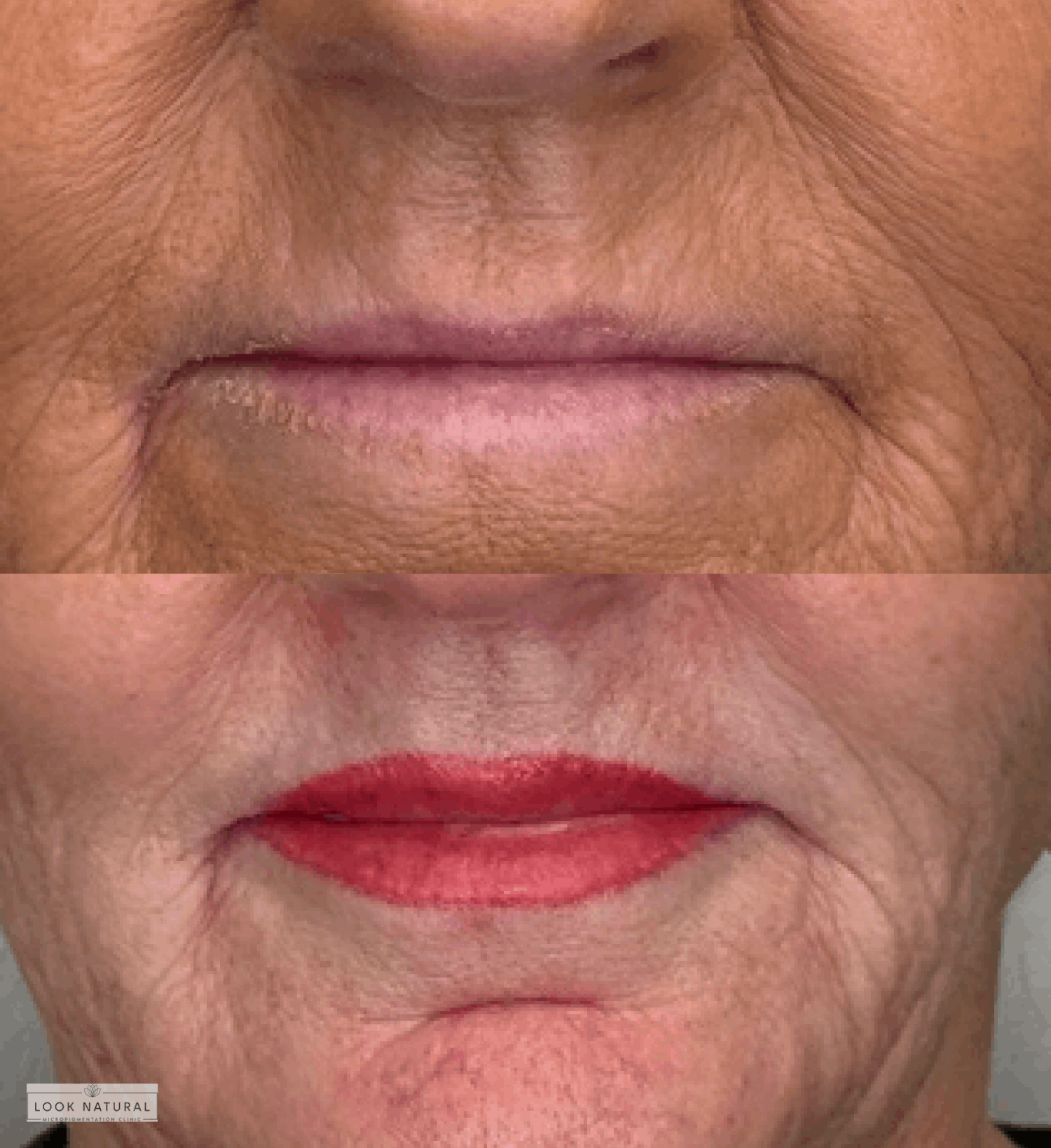 Semi-permanent lip color treatment for mature lips showing natural pinkish enhancement.
