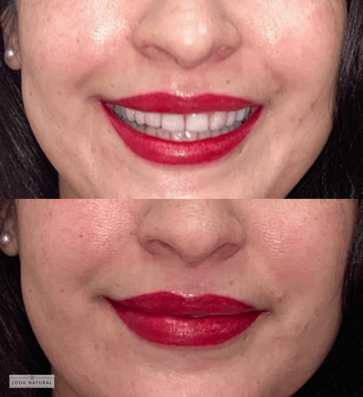 Semi-permanent lip color treatment before and after result with rich red pigmentation.