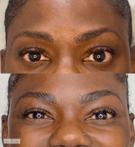 Fuller, defined eyebrows after expert restoration treatment.
