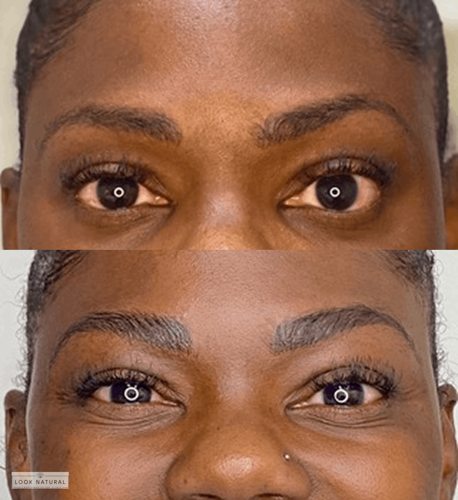 Fuller, defined eyebrows after expert restoration treatment.