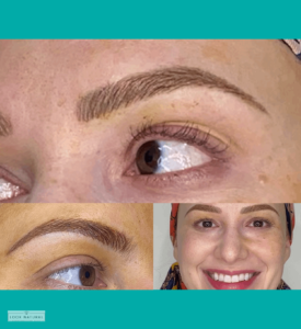 Perfectly restored natural brows with expert microblading.