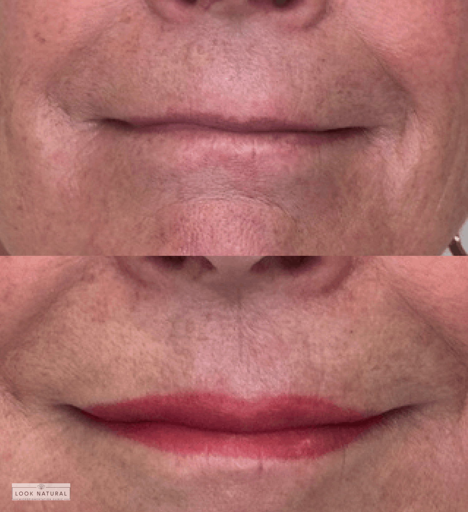 Before and after semi-permanent lip color treatment for subtle and natural lip enhancement.