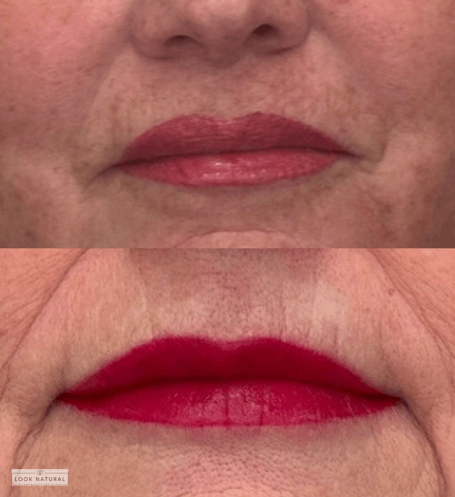 Before and after semi-permanent lip color procedure showing enhanced pigmentation and definition.