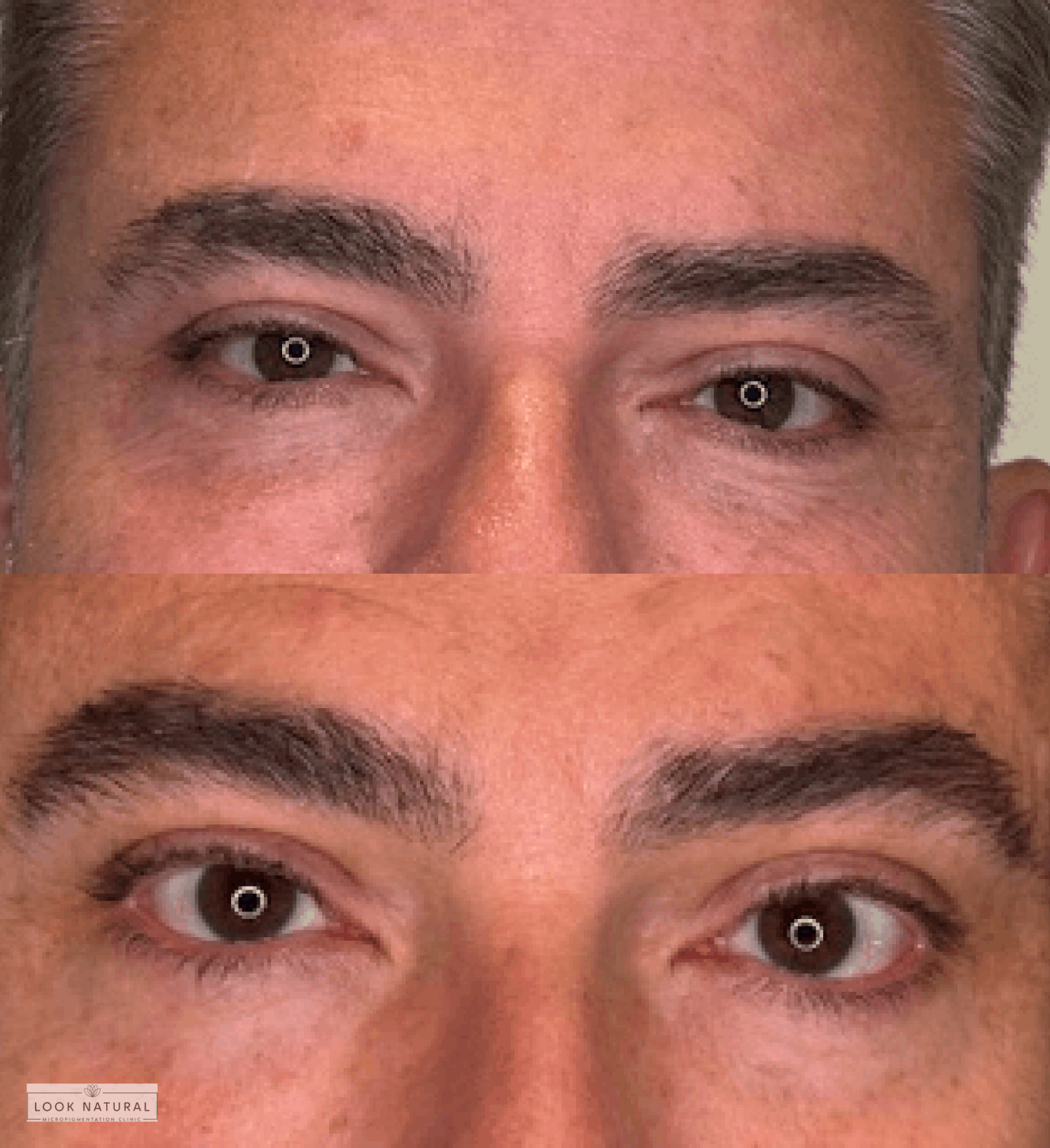 Before and after men’s eyebrow restoration showcasing thicker, more defined brows.