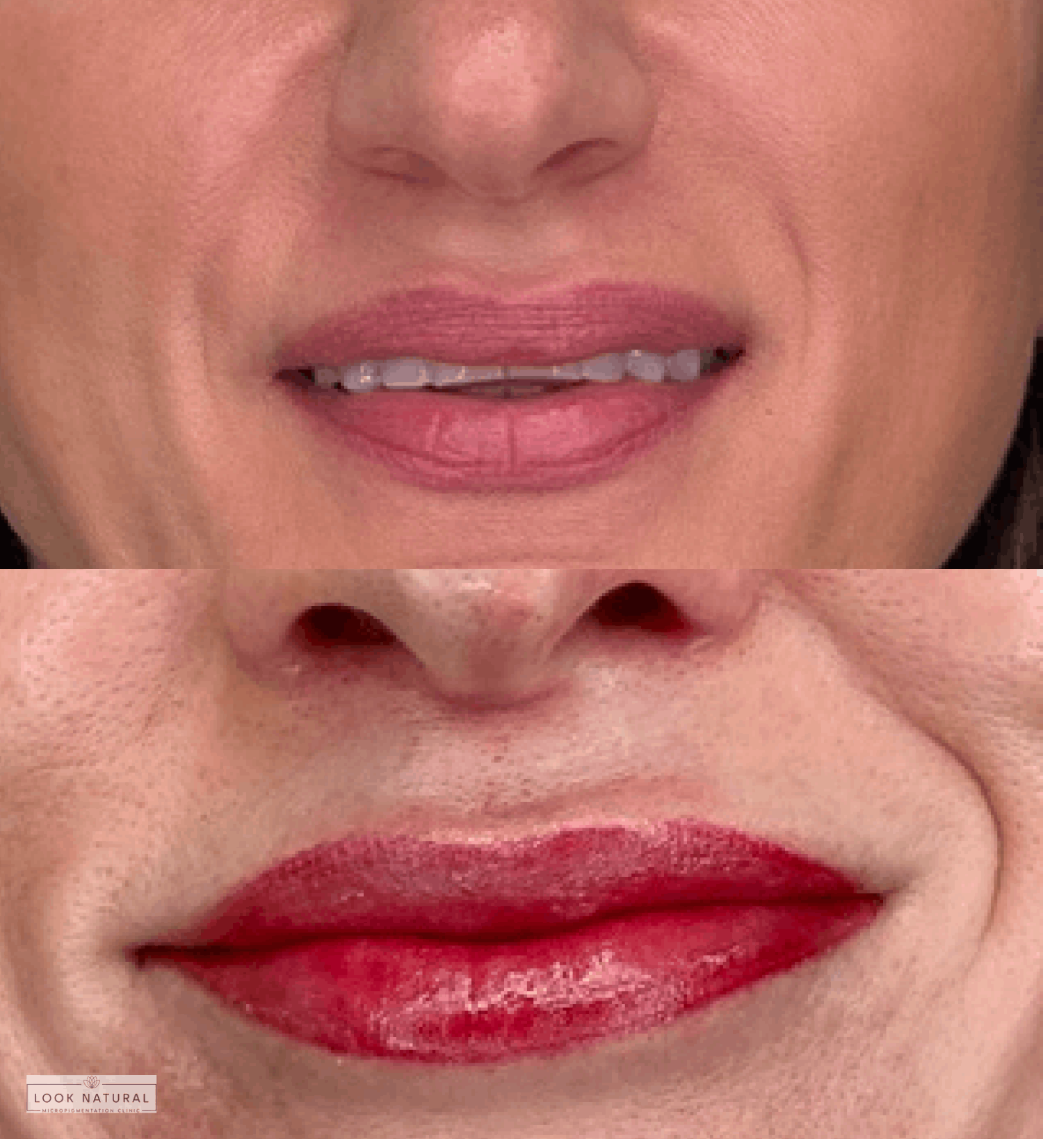 Before and after semi-permanent lip color treatment with natural-looking pigmentation.