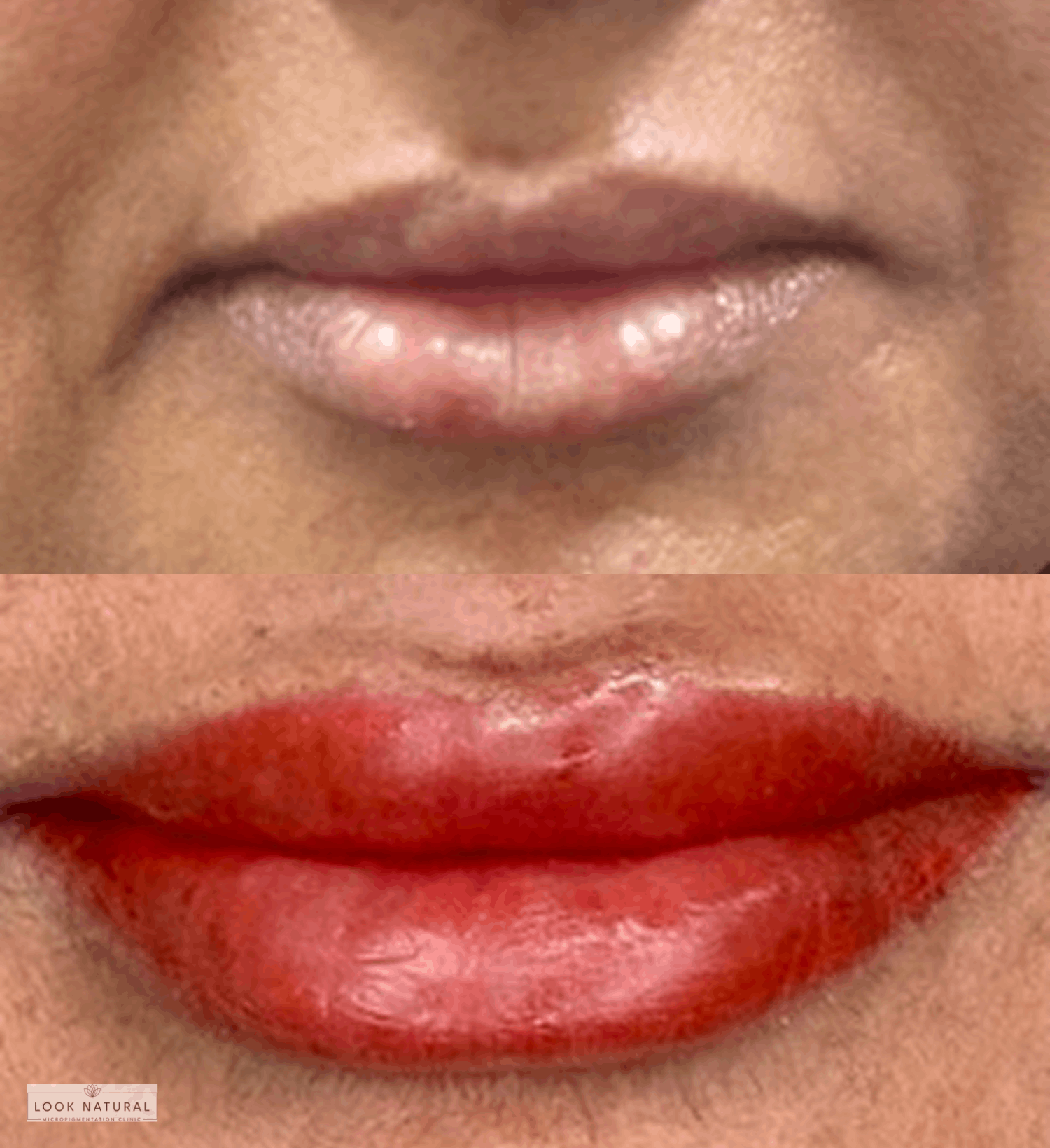Lip neutralization and lightening with color correction before and after results
