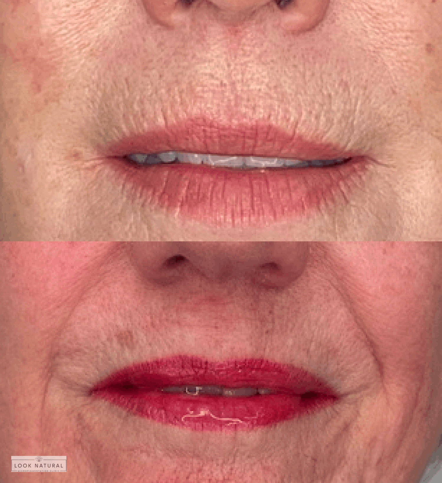 Before and after semi-permanent lip color treatment showing improved lip tone and vibrant color.