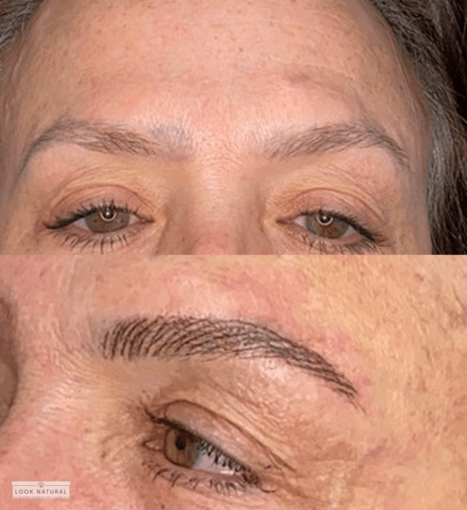 Before and after eyebrow restoration with improved definition and fuller brow appearance.