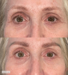 Before and after eyebrow restoration showing transformation from thin, faded brows to naturally shaped, fuller eyebrows.
