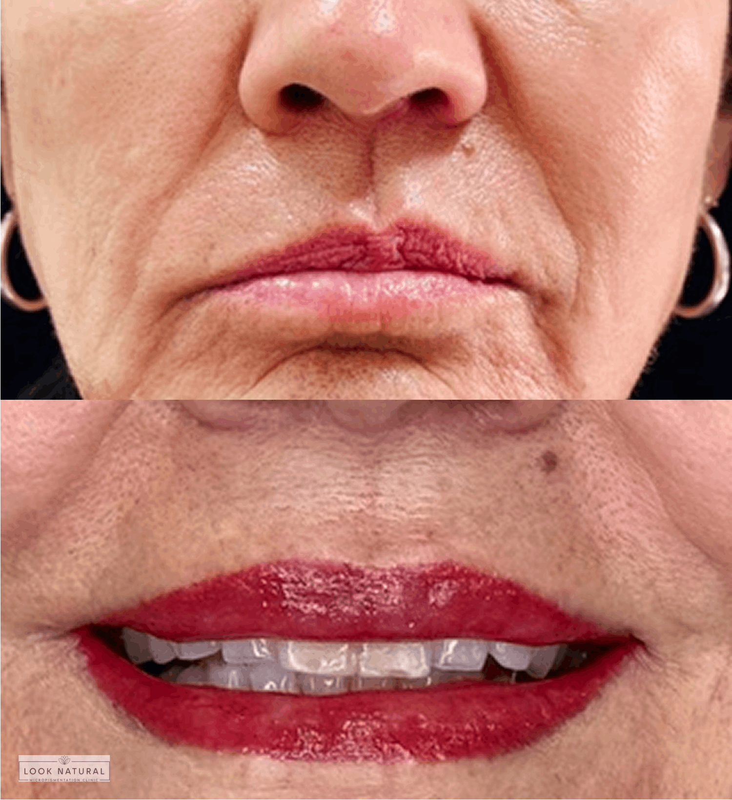 Before and after semi-permanent lip tattoo treatment restoring lip color and definition for mature lips.