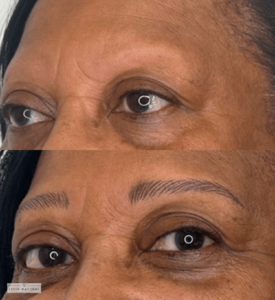 Before and after eyebrow restoration showing transformation from sparse, missing brows to naturally defined, fuller eyebrows.