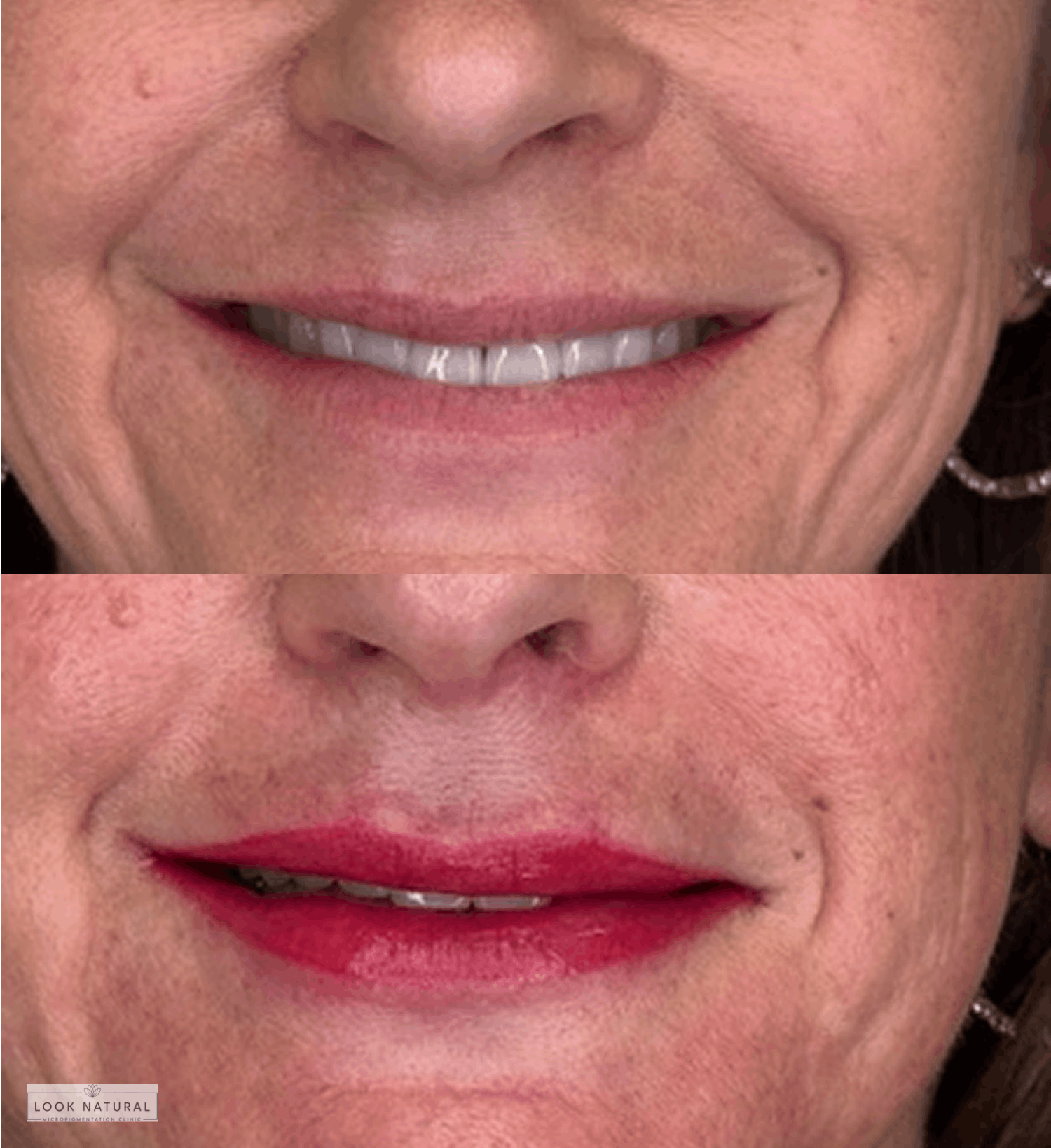 Before and after semi-permanent lip tattoo treatment with natural red pigment for enhanced definition.