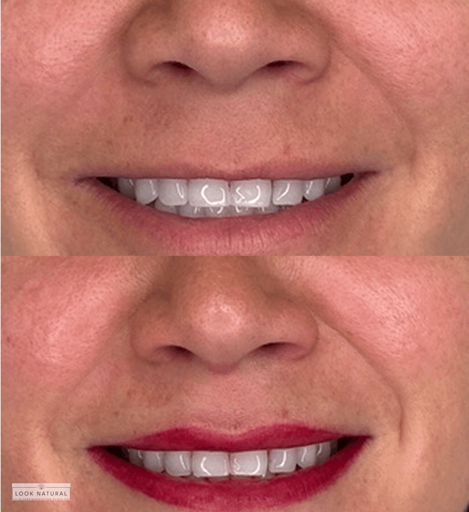 Before and after semi-permanent lip color treatment on upper lip, enhancing natural shape with soft red pigment.