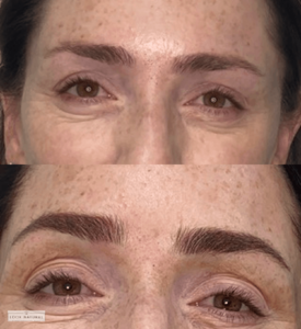 Before and after eyebrow restoration showing transformation from slightly sparse brows to naturally fuller and perfectly defined eyebrows.