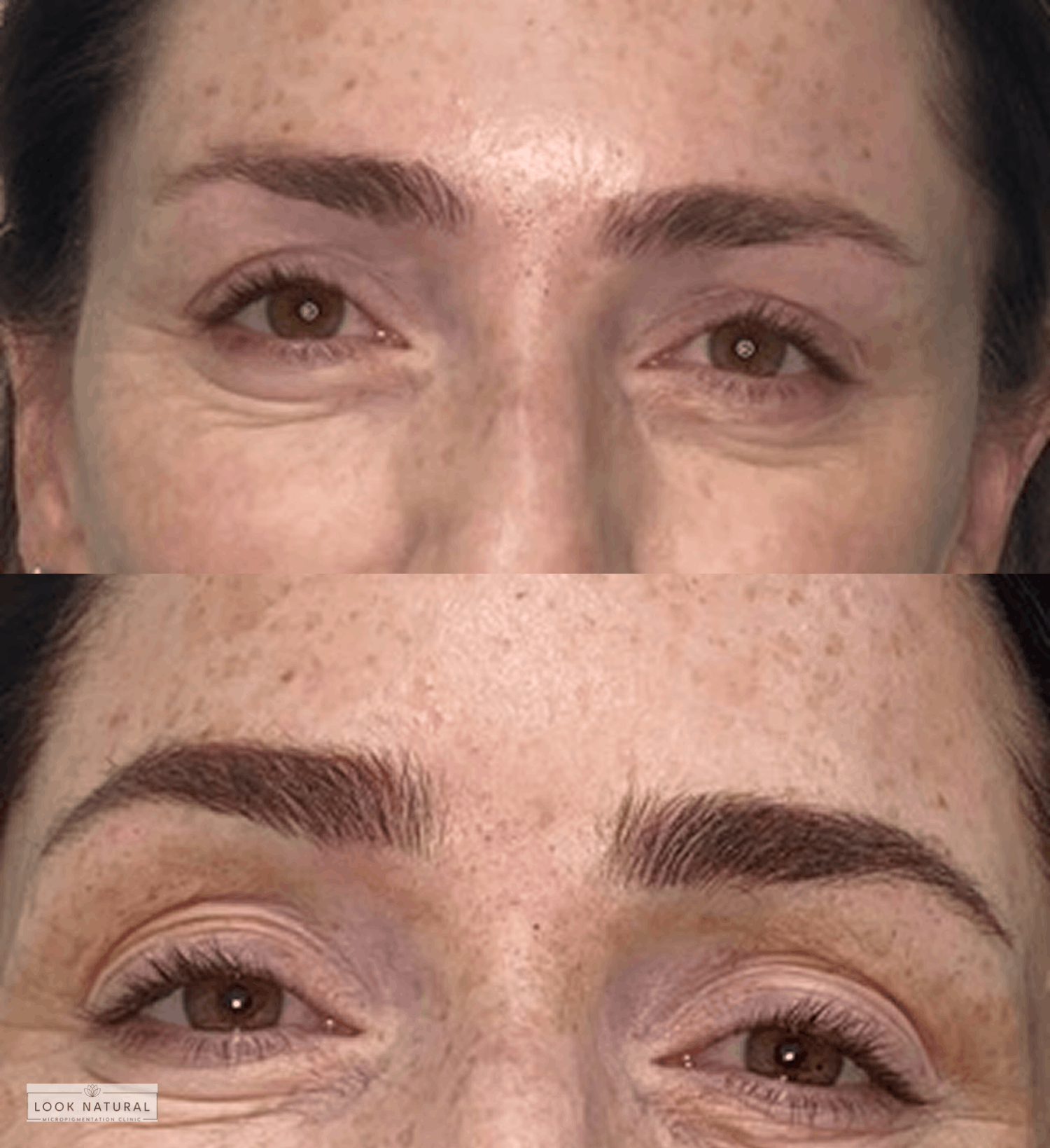 Before and after eyebrow restoration showing transformation from slightly sparse brows to naturally fuller and perfectly defined eyebrows.
