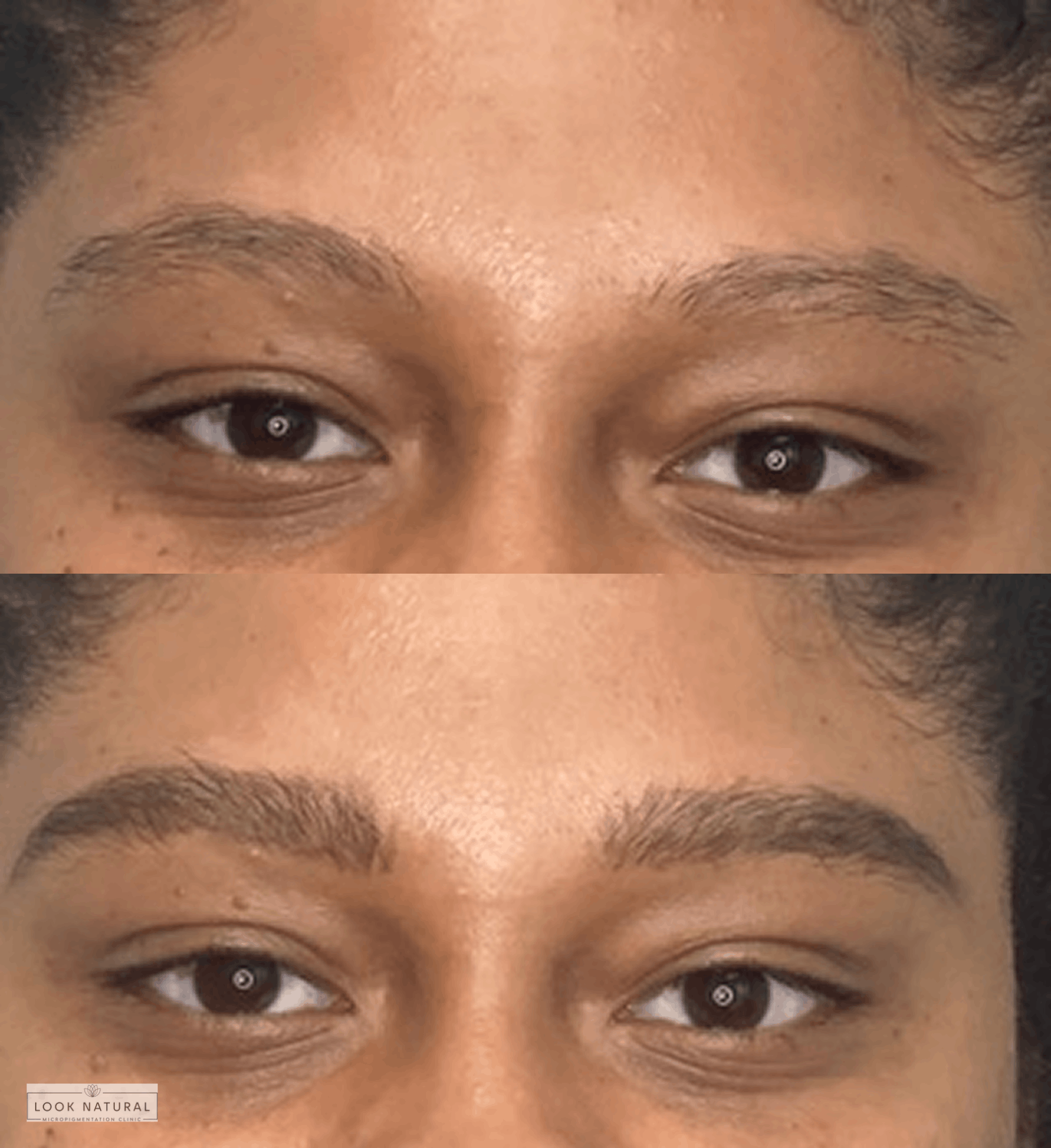 Before and after eyebrow restoration showing transformation from sparse brows to naturally fuller, well-shaped eyebrows.