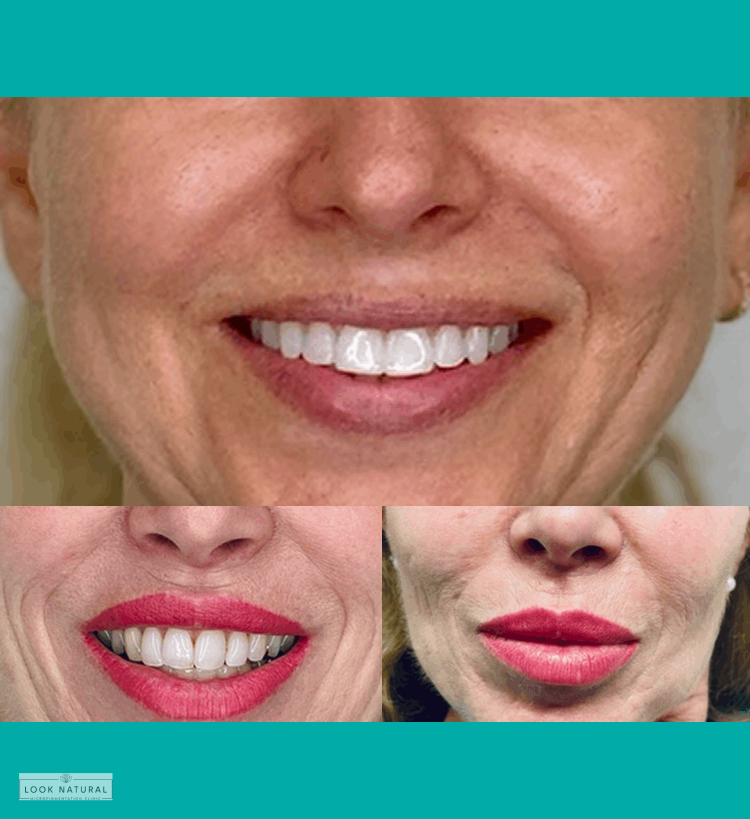 Woman showing before and after results of semi-permanent lip color treatment