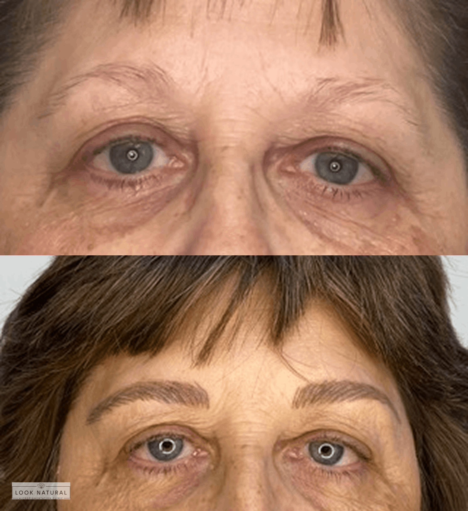 Before and after eyebrow restoration image showcasing transformation from thin, faded brows to fuller, well-defined natural eyebrows.