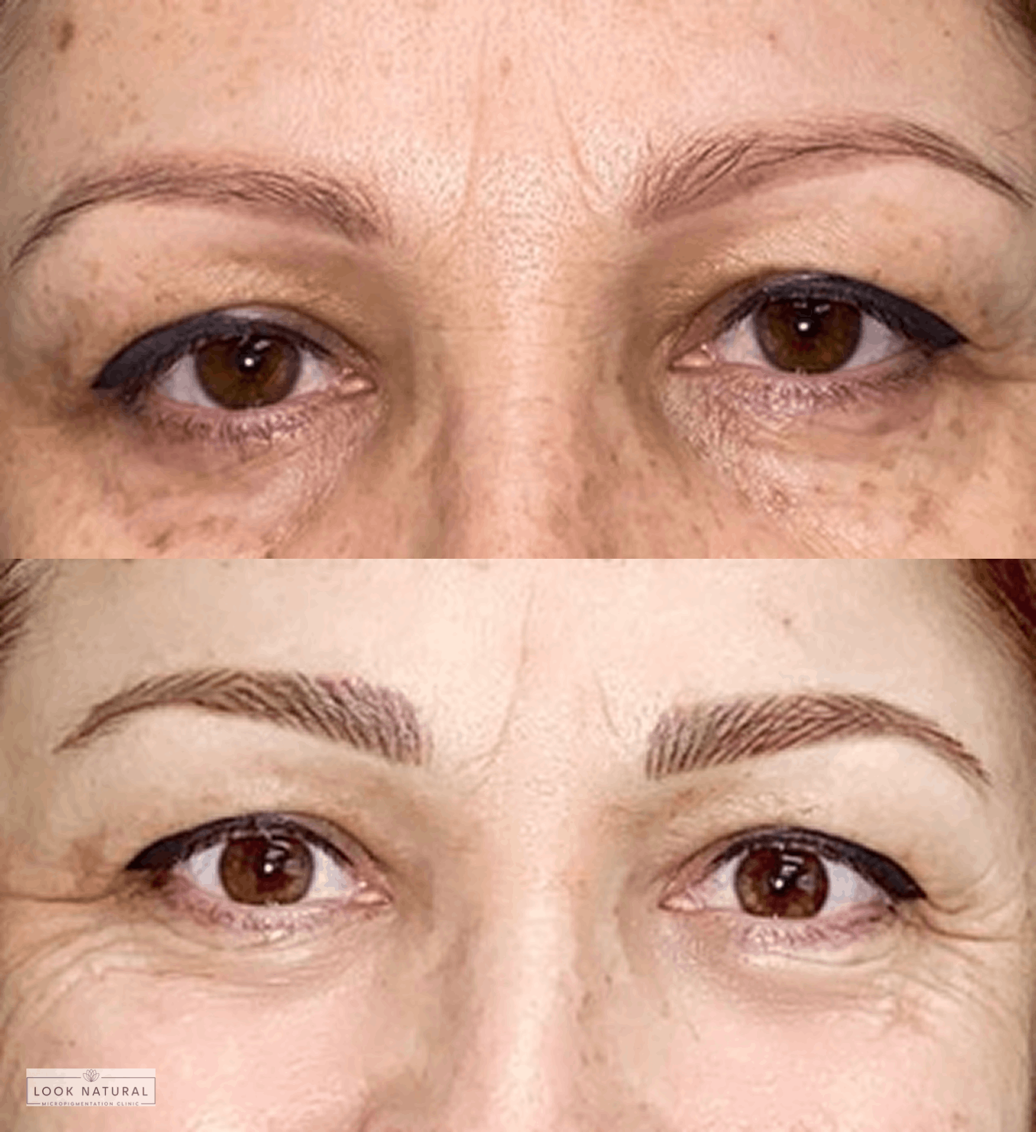 Before and after image of women's eyebrow restoration showing a natural transformation from thin brows to well-defined, fuller eyebrows.