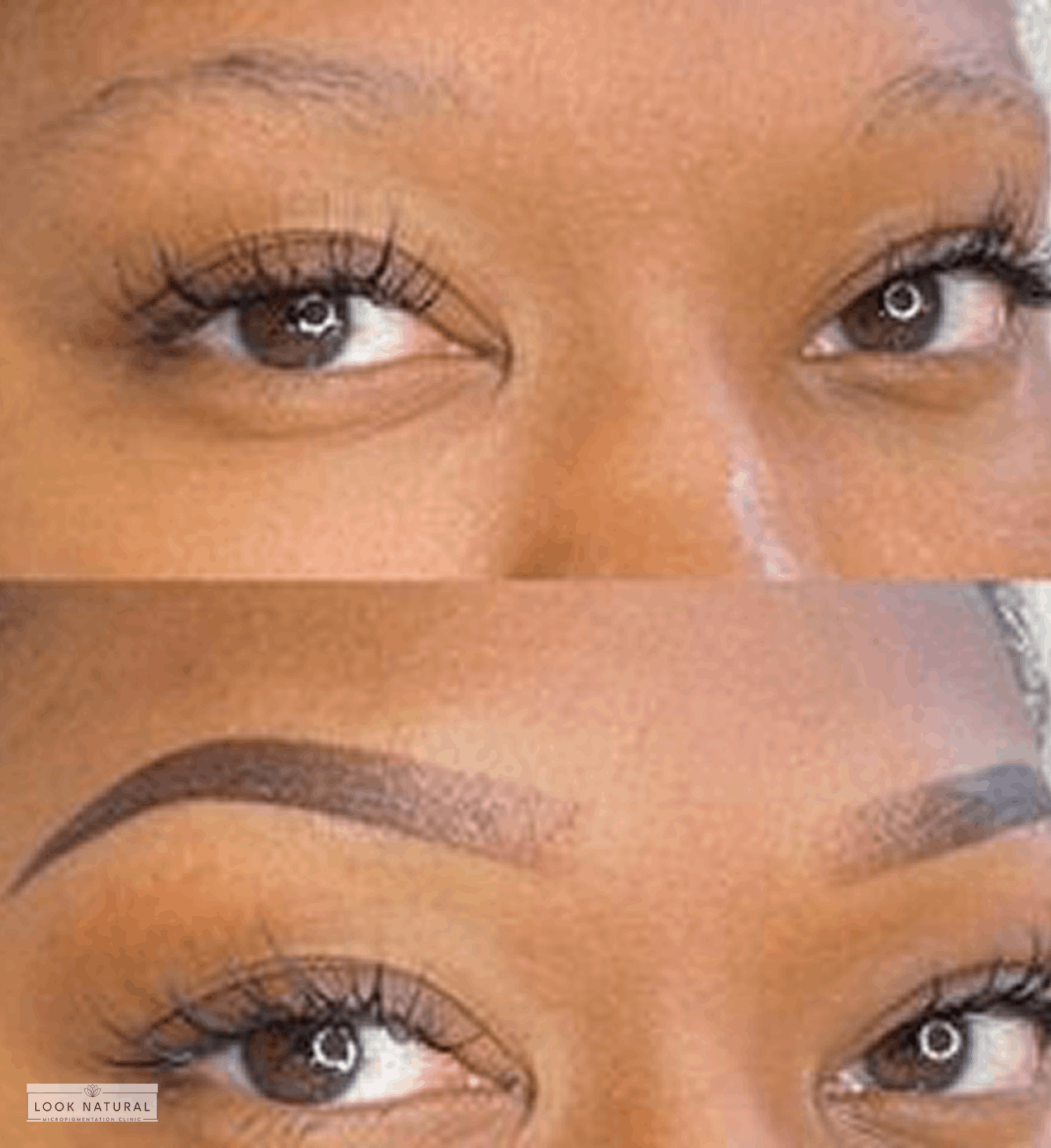 Women’s eyebrow restoration before and after results showing fuller, well-defined brows.