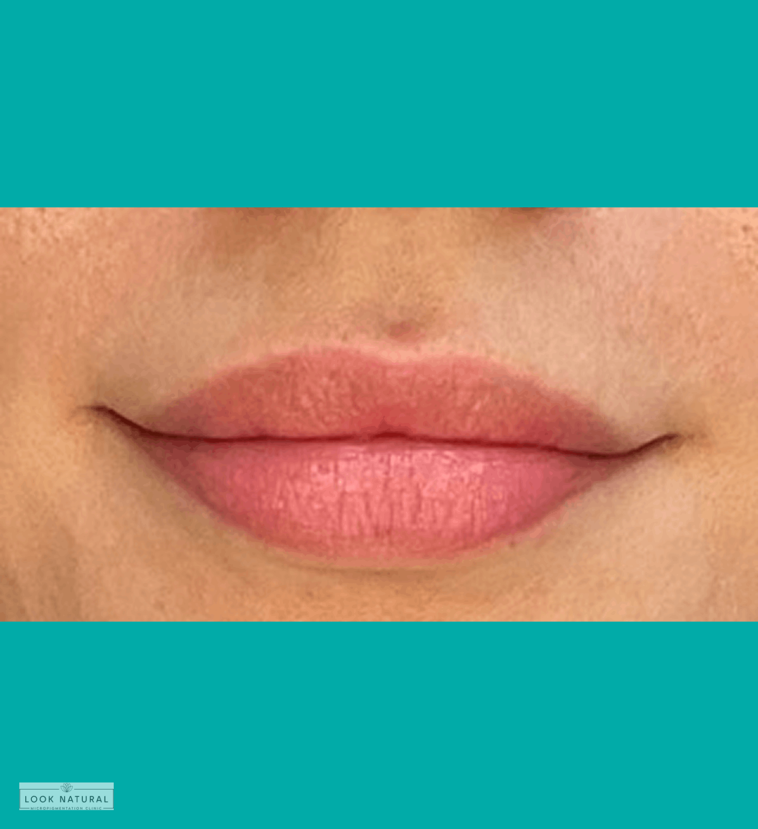 Healed lip blushing results with soft pink pigment on natural lips