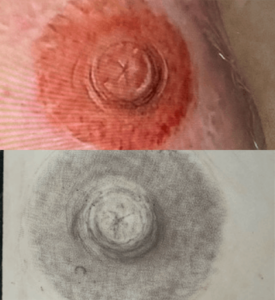Before and after detailed 3D nipple areola tattooing
