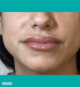 08_Semi-Permanent Lip Color Single-1 | Look Natural Micropigmentation Clinic Healed semi-permanent lip color treatment with natural pink shade