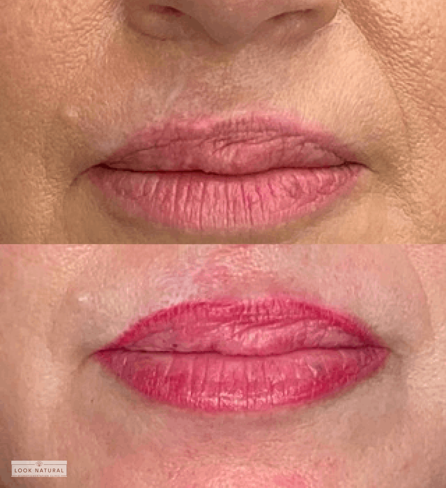 Before and after lip micropigmentation treatment showing enhanced lip color