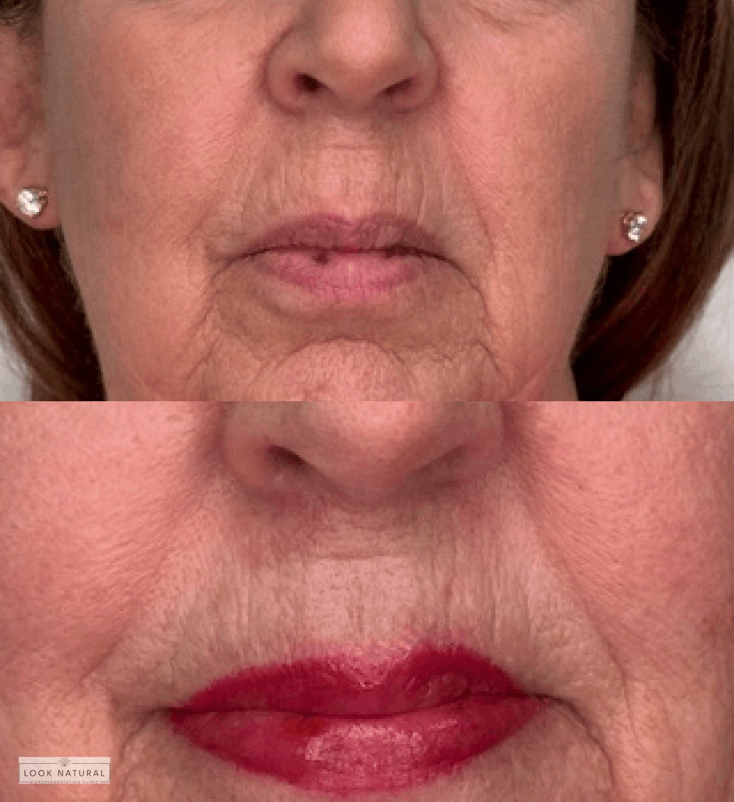 Before and after lip scar camouflage treatment with enhanced lip color on mature client