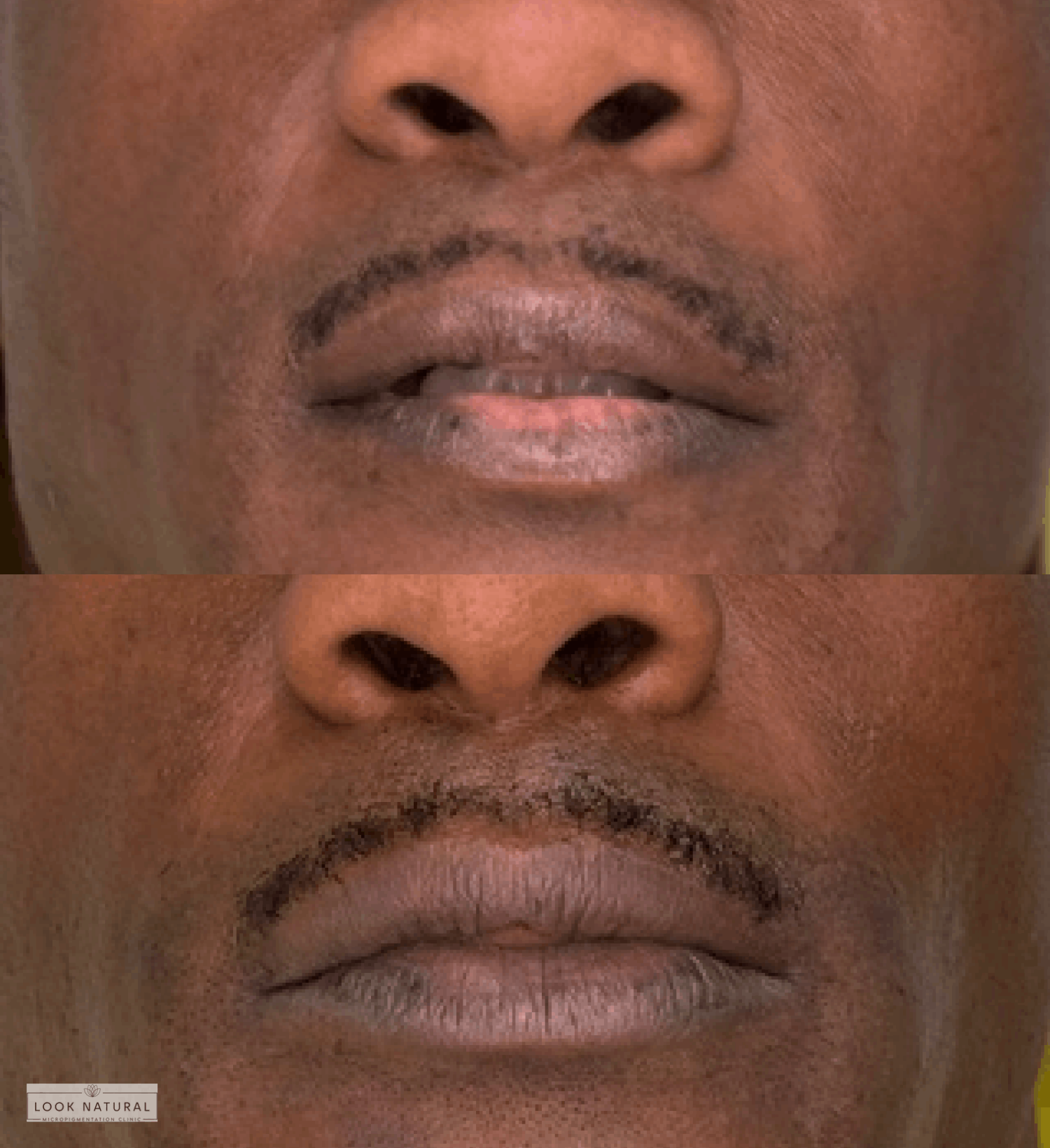 Before and after semi-permanent lip color treatment for darker lips