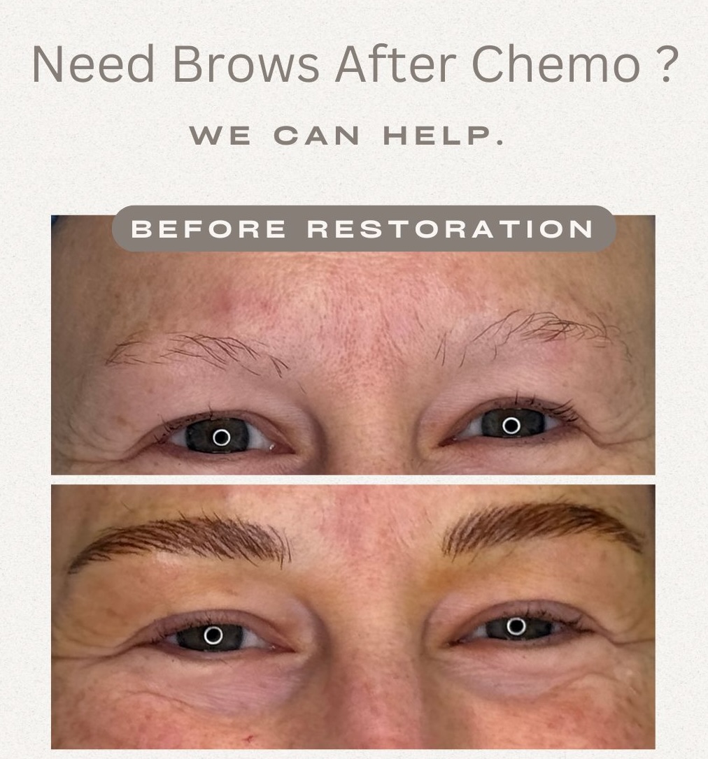 Before and after close-ups of eyes showing eyebrow restoration: top image sparse brows before chemo, bottom image fuller, shaped brows after treatment.