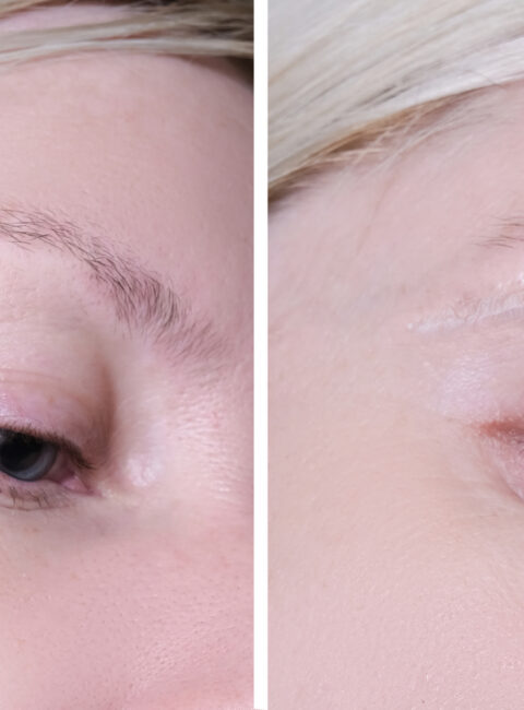 Close-up side-by-side of a woman's eye area showing before (left) and after (right) eyebrow microblading/healing progress.