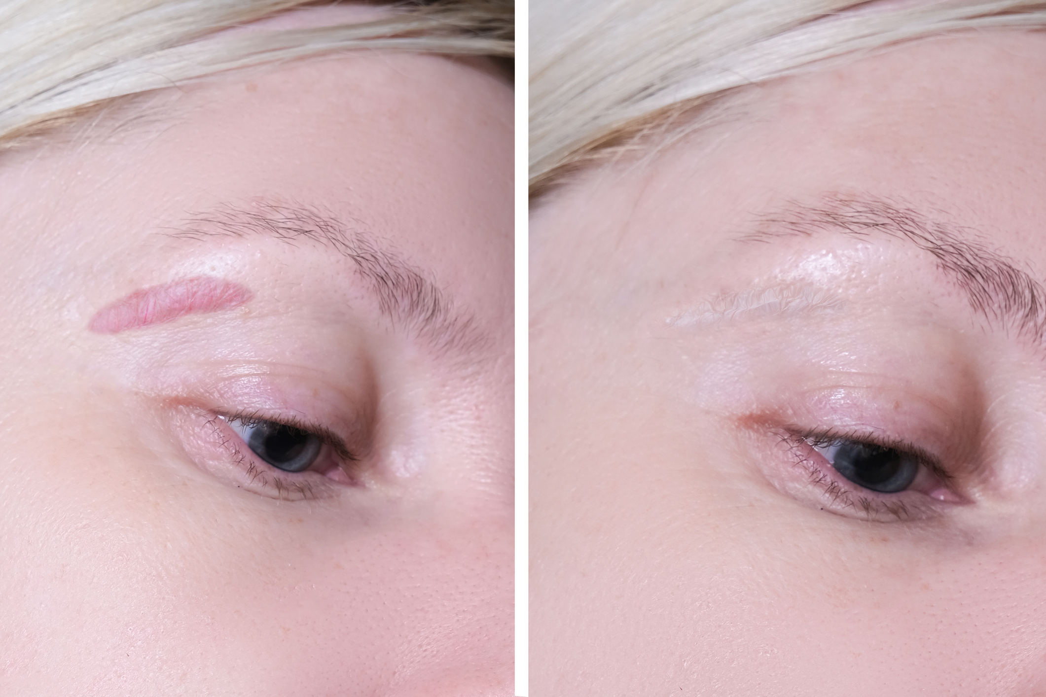 Close-up side-by-side of a woman's eye area showing before (left) and after (right) eyebrow microblading/healing progress.