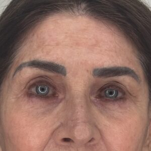 Before Brow Correction Tattoo